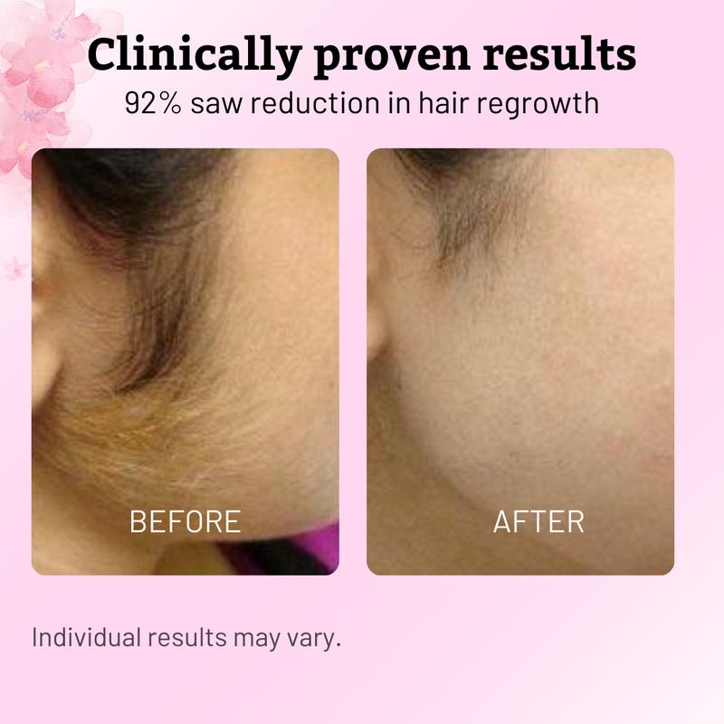 Cyperus Rotundus Oil Hair Removal Serum